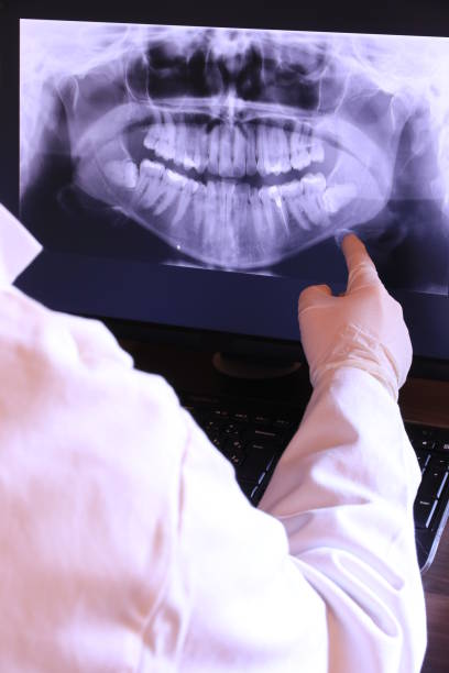 Best Emergency Root Canal Treatment in Tidmore Bend, AL