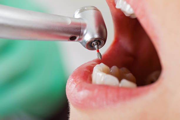 Best Emergency Dental Care for Broken or Chipped Teeth in Tidmore Bend, AL